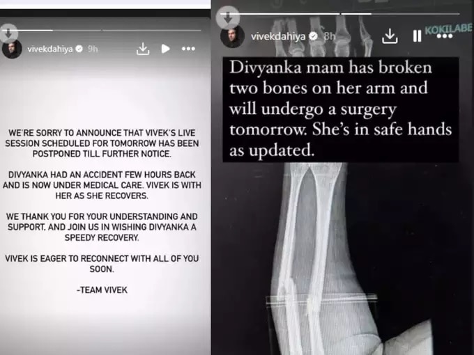 actress Divyanka Tripathi met an Accident Husband Vivek Dahiya Shares Health Update