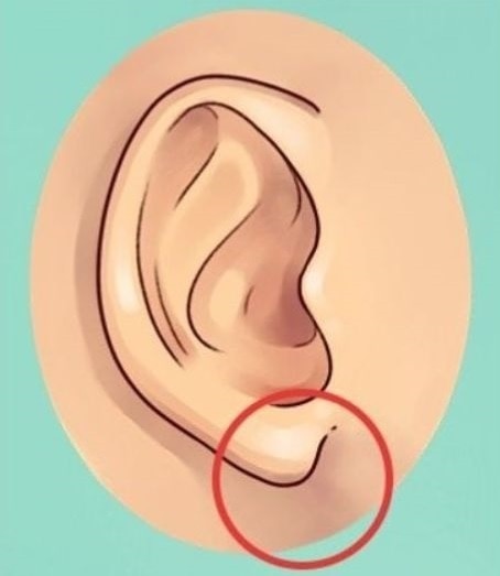 Ear Shape Personality Test What Your Earlobes Reveals About You