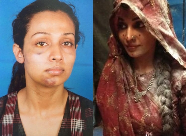 shocking Bollywood Actres Flora Saini boyfriend once beaten her brutally 
