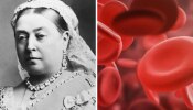 World Hemophilia Day : इंग्लंडच्या विक्टोरिया राणीला जीवघणे आजाराची लागण, रक्ताचं होतं पाणी, असे होतात हाल 
