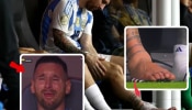 Copa America final : सामन्याचा अंतिम थरार अन् मेस्सीचा पाय सुजला; स्वत:ला हतबल पाहून ढसाढसा रडला, पाहा Video