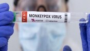 Monkeypox Virus:  मंकीपॉक्सनं वाढवली चिंता; भारतातही नवे नियम लागू, कोरोनाचेच दिवस परततायत? 