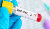 आधी मंकीपॉक्स आता Nipah Virus चा धोका, देशात 24 वर्षांच्या तरुणाचा मृत्यू... , वेळीच ही लक्षणं ओळखा?