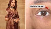 कॅन्सरशी लढणाऱ्या Hina Khan ने पोस्ट केला फोटो; पापणीत उरला एकच केस...