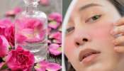 उन्हाळ्यात चेहऱ्याला सतत गुलाब पाणी लावणं धोक्यादायक; 5 Side Effects 