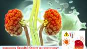 Kidney Health : उन्हाळ्यात केल्या जाणाऱ्या 5 कामांमुळे खराब होते किडनी; 99% लोकांना याची माहितीच नाही 