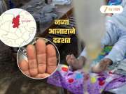 बुलढाण्यात पुन्हा रहस्यमय आजाराचं थैमान! हातांवर दिसतायेत लक्षणं; तातडीने डॉक्टरांचं विशेष पथक रवाना