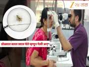 Video: धक्कादायक! वृद्धेच्या पापण्यांतून निघाल्या 250 उवा अन् 80 अंडी; गुजरातमधील घटना 