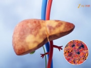 रात्री चुकूनही खाऊ नका &#039;हे&#039; पदार्थ, फॅटी लिव्हरची समस्या 100 पटीने वाढेल 