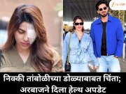 निक्की तांबोळीच्या डोळ्याबाबत चिंता; अरबाजने दिला हेल्थ अपडेट