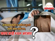 Explained: जखमेचे हाडात रूपांतर करणारा दुर्मिळ आजार; राजस्थानमधील 9 वर्षाच्या मुलाचे शरीर बनत आहे दगड, काय आहे FOP आजार