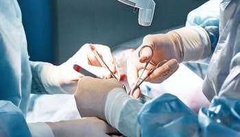 नाशिकमध्ये त्वचारोग तज्ज्ञाचे बिंग फुटले; पदवी नसतानाही रुग्णाच्या नाकावर उपचार केले अन् चेहराच... 