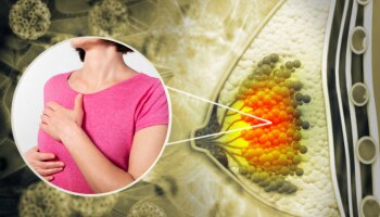 स्तनांमधील &#039;हे&#039; 5 संकेत सांगतात कॅन्सरची झालीय लागण, घाबरु नका लगेच करा हे उपाय