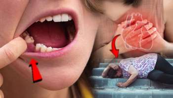 दातांचा अन् Heart Attack चा थेट संबंध! संशोधकांचा दावा; समजून घ्या नेमकं कनेक्शन