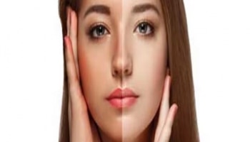 कोणत्या व्हिटॅमिनच्या कमतरतेमुळे चेहरा पडतो काळा? जाणून घ्या
