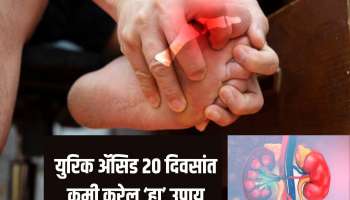 Uric Acid ने त्रासले आहात, आजपासूनच सुरु करा 3 कामे; 20 दिवसात दिसेल जबरदस्त फरक