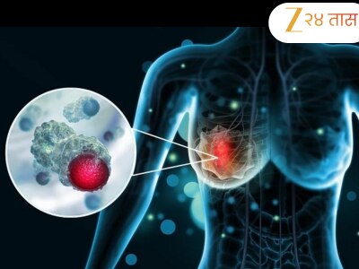 ब्रेस्ट कॅन्सर आहे की नाही अवघ्या 2 मिनिटांत ओळखा; डॉक्टरांनी सांगितला सोपा उपाय 