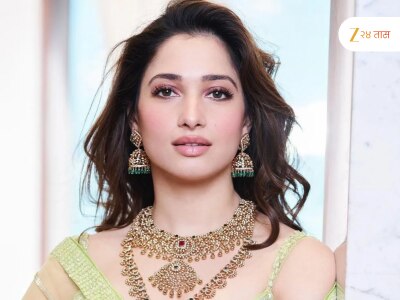Tamannaah Bhatia पिंपल्स दूर करण्यासाठी सकाळी लावते पहिली थुंकी, डॉक्टरांनी सांगितलं सत्य काय?