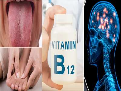डोकेदुखी, अस्वस्थ वाटणे, तोंडाला फोड येणं अजीबात दुर्लक्ष करु नका;  Vitamin B12 च्या कमतेरतेमुळे गंभीर आजारांचा धोका? 