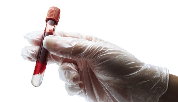प्रयोगशाळेत रक्त बनवणं 2017 मध्ये होईल शक्य