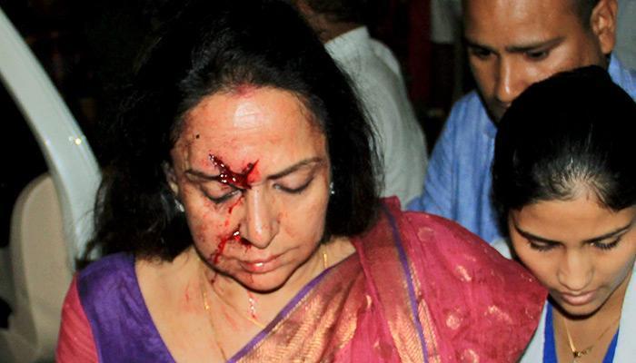 Hema Malini injured in road accident