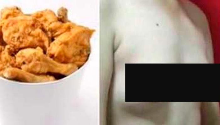 फ्राइड चिकन खाल्ल्यानं चीनी पुरुषात विकसित झालं स्तन