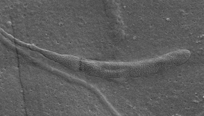 संशोधकांनी शोधला ५ कोटी वर्षांपूर्वीचा शुक्राणू 