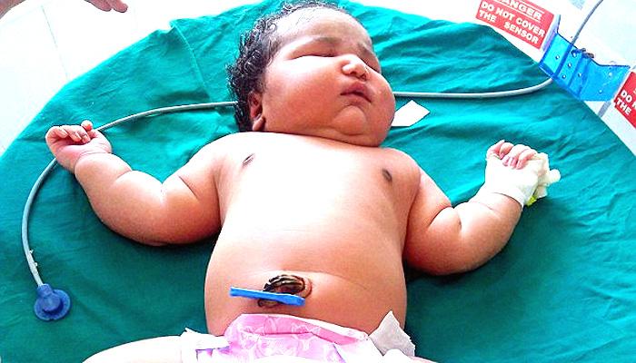 भारतात जन्मली जगातली सर्वाधिक वजन असलेली मुलगी