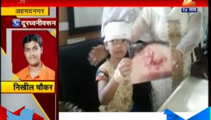 Ahmadnagar 6 Year Old Girl Gets Bitten By Stray Dog