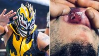 WWE:चाहत्याच्या बाटली हल्ल्यात रेसलर जखमी