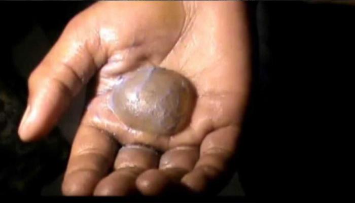 चोरी पकडण्यासाठी प्राचार्यांनी मेणबत्तीवर जाळले चिमुरड्यांचे हात 