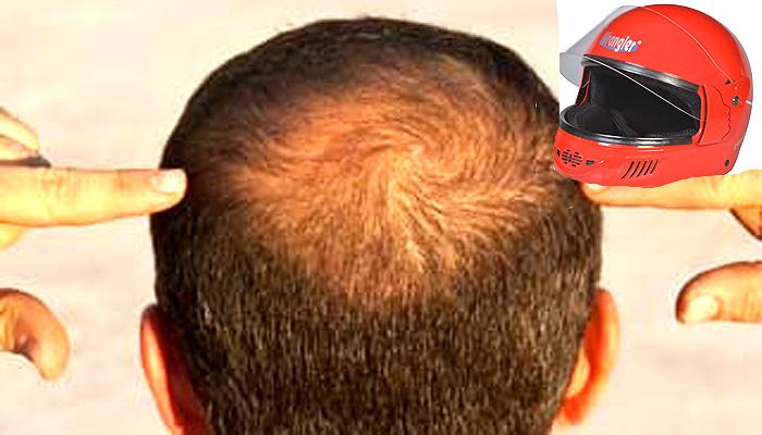 हेल्मेटच्या वापरामुळे खरंच केसगळती वाढते का | Does Wearing a Helmet Cause  Hair Loss | Health Tips In Marathi