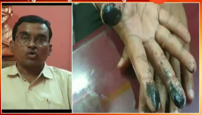 Election Officer Three Fingers Injured By Putting Ink On Voters Fingers