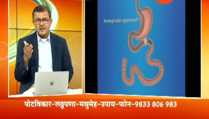 Hello Doctor Dr Amit Maydeo On Diabetes And Obesity Treatment 7 July 2019