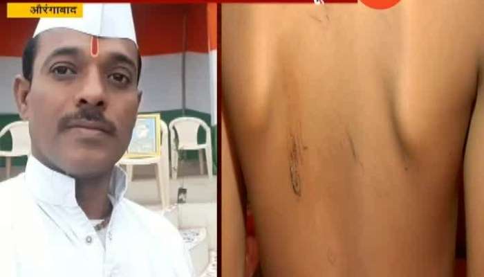  Aurangabad Teacher Beat Student With Wire For Eating 2 Biscute Without Permission