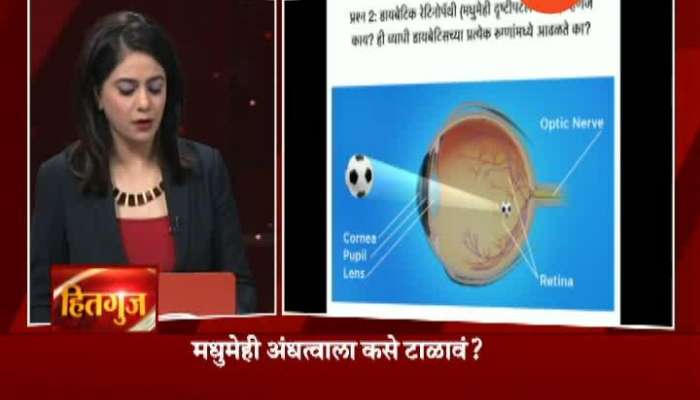 Hitguj Dr Paritosh Kamdar And Dr Ajay Tammewar On Curing Blindness From Diabetics 28 Jan 2020