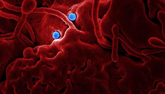कोरोना व्हायरस : रोगापेक्षा उपचारच जीवावर बेतला; २७ लोकांचा मृत्यू 