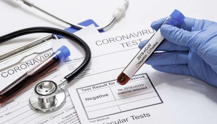 महत्त्वाची बातमी : तुमच्या आरोग्य विम्याच्या यादीत कोरोना व्हायरसचं नाव आहे का?