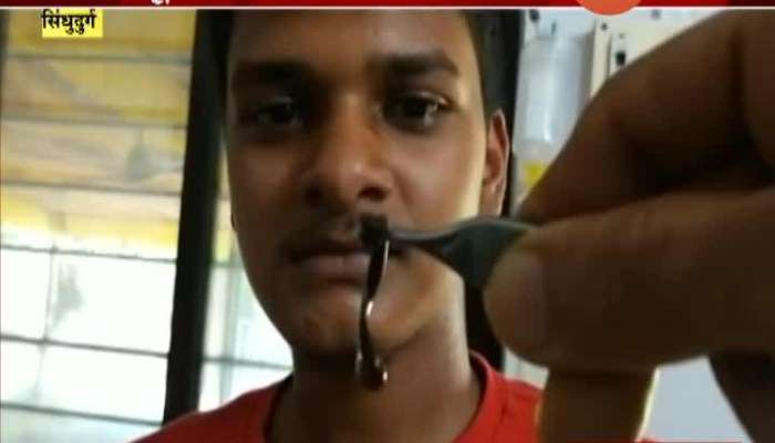 Sindhudurg Worm Removed From Nose