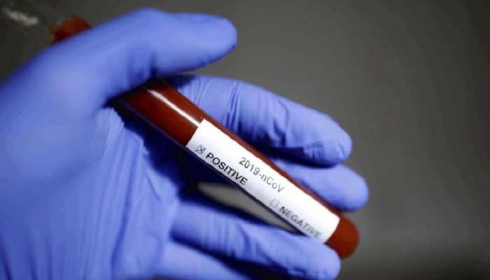 देशात आतापर्यंत १ कोटी लोकांच्या कोरोना चाचण्या- ICMR