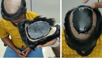 सोन्याची तस्करी करायला डोकं लावलं, पण डोकं उघडूनच कस्टम अधिकाऱ्यांनी पाहिलं