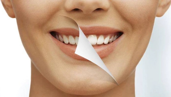पिवळ्या दातांमुळे दिलखुलास हसण्याची लाज वाटतेय? दात स्वच्छ ठेवण्यासाठी वाचा या गुणाकारी टीप्स