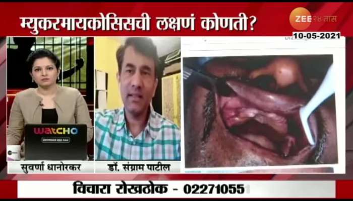 RokhThok Dr Sangram Patil  On What Is Mucormycosis Question