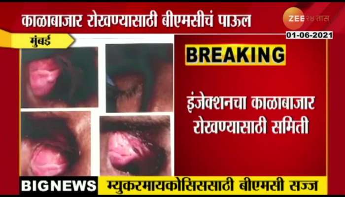 Mumbai Surge With 400 Patients Of Mucormycosis
