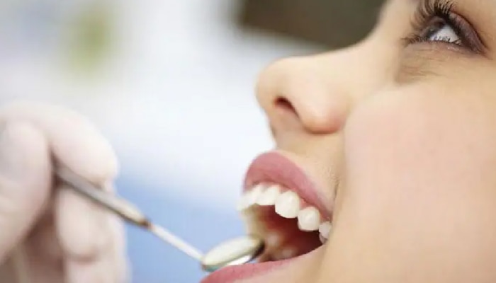 Oral Health : दातदुखीने त्रस्त आहात? मग हे घरगुती उपाय वापरा