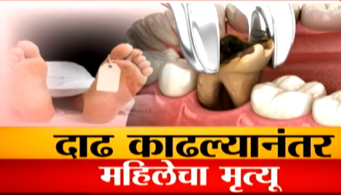 दाढ काढल्यानंतर महिलेचा मृत्यू, एका दाढेनं घेतला जीव?