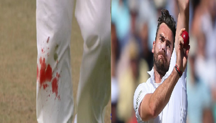 INDvsENG TEST CRICKET : ​गुडघ्यातून रक्त वाहत होतं, पण तो गोलंदाजी करत राहिला 