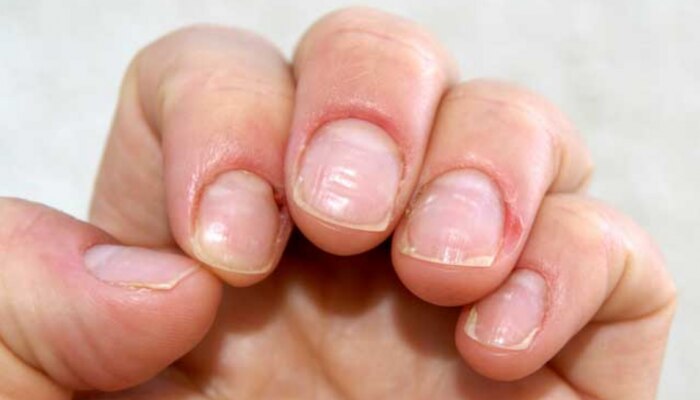 Nail Shape : नखांचा आकार सांगतो तुमची पर्सनॅलिटी, जाणून घ्या कसं?