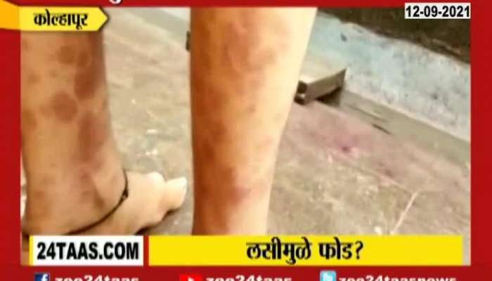 Kolhapur Women Complaint On Side Effect Of Vaccination