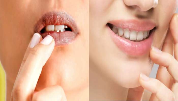 lip care tips: काळे पडले ओठ तर करा हे घरगुती उपाय